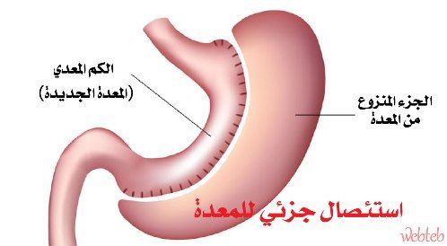 السرطان من الأمراض المعدية